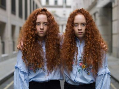 Πανομοιότυπα δίδυμα: Τόσο ίδια μεταξύ τους, μα και τόσο διαφορετικά  (pics)