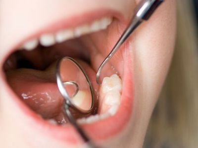 Πότε τα παιδιά βάζουν θήκες στα δόντια τους και για ποιο λόγο