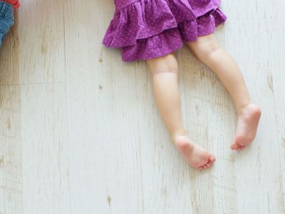 Πλατυποδία στα παιδιά και θεραπεία