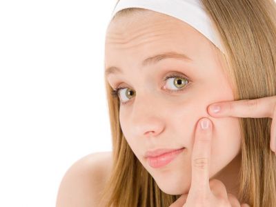 Ακμή στην εφηβεία: Πώς να βοηθήσετε το παιδί σας να την αντιμετωπίσει