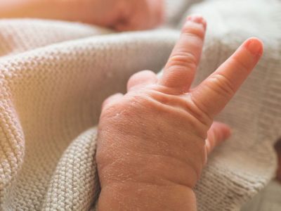 Αντανακλαστικά: Τα καταπληκτικά πράγματα που το μωρό σας μπορεί να κάνει αυτόματα