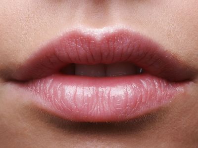 9 συμβουλές για να θεραπεύσετε τα σκασμένα χείλη τον χειμώνα