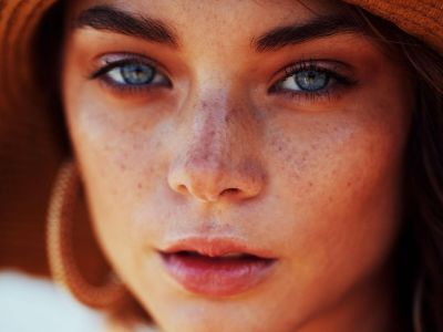 5 σημάδια στο δέρμα σου που φανερώνουν έλλειψη βιταμίνης D