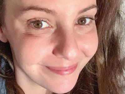 Το μεγάλο μάθημα που πήρα όταν απέκτησα ακμή στα 30 μου