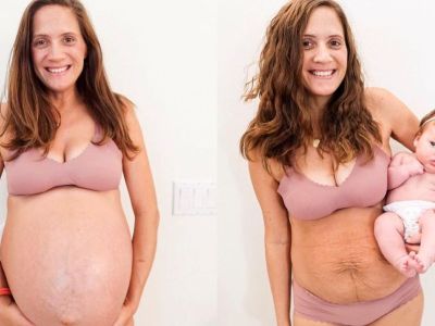 Πριν και μετά: Μαμά ποζάρει μετά τον τοκετό και στέλνει το δικό της μήνυμα