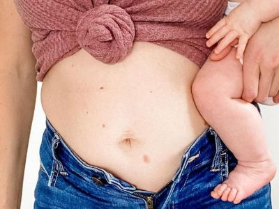 Δεν αγαπώ πάντα το σώμα που απέκτησα μετά τον τοκετό