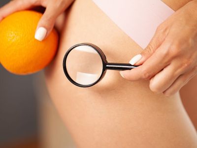 Tips για μαμάδες: Μειώστε την κυτταρίτιδα με υλικά που έχετε σπίτι σας