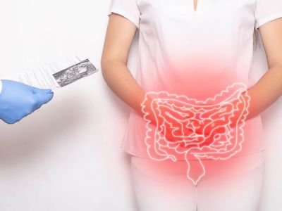 Φλεγμονή εντέρου: Με ποια συμπτώματα εκδηλώνεται (εικόνες)