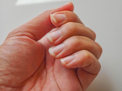 Νύχια: Οι 7 καθημερινές συνήθειες που τα καταστρέφουν (pics)