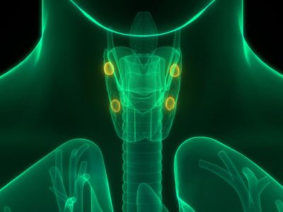 Δυσλειτουργία παραθυρεοειδών αδένων: Οι πιθανές επιπτώσεις (εικόνες)