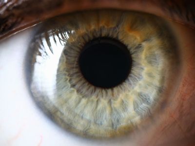 Οι σοβαρές παθήσεις που φαίνονται στα μάτια σας (εικόνες)