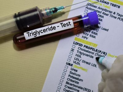 Ανεβασμένα τριγλυκερίδια: Οι τροφές που πρέπει να αποφεύγετε (εικόνες)