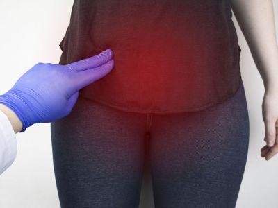 Ινομυώματα στη μήτρα: Με ποια συμπτώματα εκδηλώνονται (εικόνες)