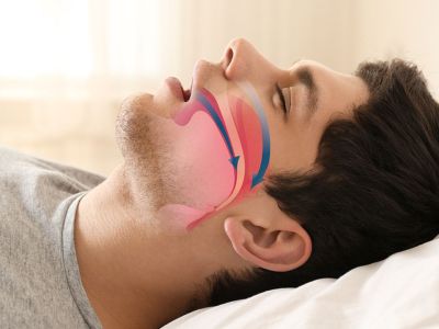 Αποφρακτική υπνική άπνοια: Από τι προκαλείται (εικόνες)