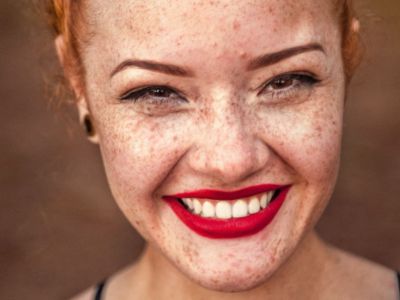 DIY! Τέλειο λευκαντικό δοντιών μόνο με δύο υλικά