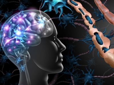 Σκλήρυνση κατά πλάκας: Οι παράγοντες που αυξάνουν τον κίνδυνο (εικόνες)