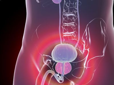 Καλοήθης υπερπλασία προστάτη: Πώς θα βελτιώσετε φυσικά τα συμπτώματα (εικόνες)