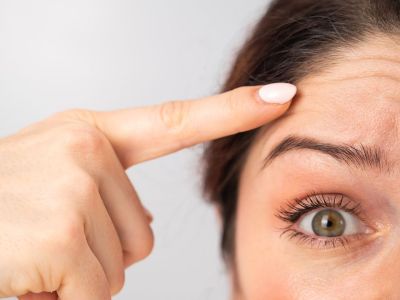 Οι τροφές που γερνάνε πρόωρα την επιδερμίδα του προσώπου (εικόνες)