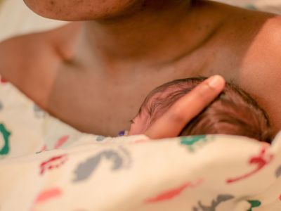 Πώς η επαφή δέρμα με δέρμα ωφελεί το νεογέννητο μετά τη γέννα