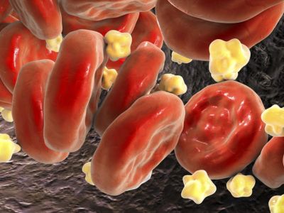 Πέντε πανεύκολα βήματα για τη μείωση της χοληστερίνης (εικόνες)