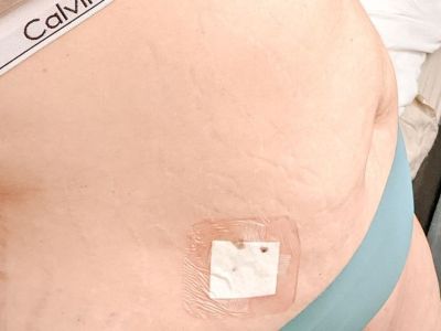 Τα σημάδια μου και οι ουλές μου είναι ο χάρτης της ζωής μου