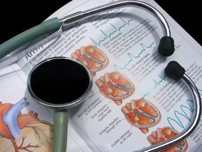 Κολπική μαρμαρυγή: Οι βασικές αιτίες της καρδιακής επιπλοκής (εικόνες)