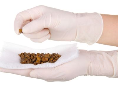 Ο τροφές που σας προστατεύουν από τον σχηματισμό λίθων στη χολή (εικόνες)