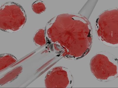 Social Freezing: Πρόληψη της γυναικείας υπογονιμότητας που σχετίζεται με την ηλικία