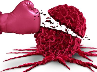 Παγκόσμια Ημέρα κατά του Καρκίνου: 10 συμπτώματα καρκίνου που πρέπει όλοι να γνωρίζουμε (εικόνες)