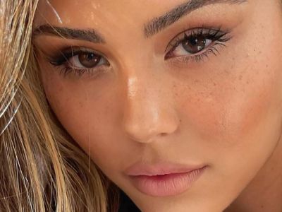 4 tips για να κάνεις ψεύτικες φακίδες που θα μοιάζουν απόλυτα φυσικές