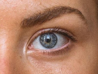 Τα σπυράκια ήταν αυτά που με έκαναν να αγαπήσω περισσότερο τον εαυτό μου