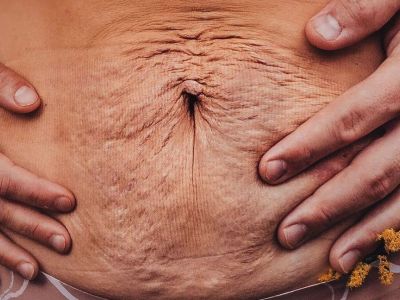 Πώς βλέπει ένας μπαμπάς το σώμα της γυναίκας του μετά τον τοκετό