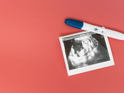 Eξωσωματική γονιμοποίηση: Ο ρόλος του DNA στην επιτυχία και την υγιή έκβασή της