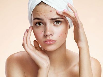 Σπυράκια: Ρουτίνα καθαρισμού προσώπου για 11χρονα