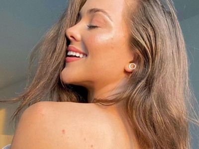 Bacne: Τα λάθη που κάνεις & πώς θα αντιμετωπίσεις τα σπυράκια στην πλάτη