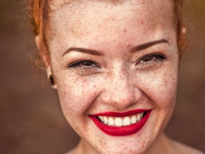 Ομορφιά για μαμάδες: Πώς να φροντίσετε τις φακίδες σας το καλοκαίρι