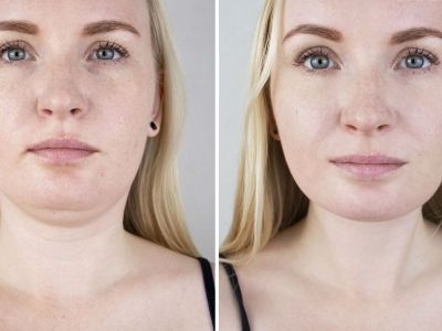 Ομορφιά για μαμάδες: Πώς να μειώσετε το πρήξιμο του προσώπου μετά τον ύπνο