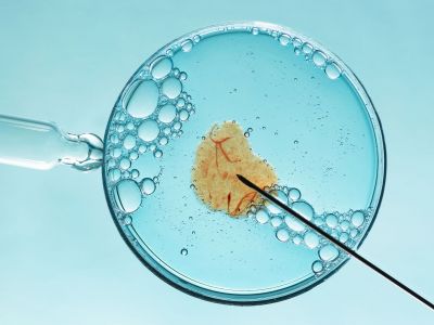 Προεμφυτευτική γενετική διάγνωση - Αναπαραγωγική λύση με αυξημένα θετικά αποτελέσματα