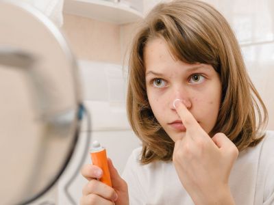 Ακμή στην εφηβεία: Πώς μπορεί να επηρεάσει την αυτοεκτίμηση των εφήβων