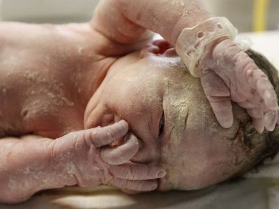Εμβρυϊκό σμήγμα ή αλλιώς vernix caseosa: Τα οφέλη για το μωρό