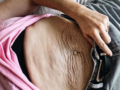 Το σώμα και πώς μοιάζει μετά τον τοκετό είναι αυτό που έχει το ελάχιστο ενδιαφέρον σε μία μαμά