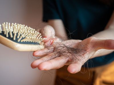Τριχόπτωση μετά τον τοκετό: Πόσο διαρκεί;
