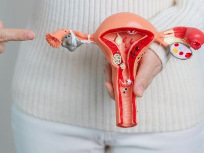 Ενδομητρίωση: Η εμπειρία της Μορφούλας Ντώνα και συμβουλές από τον ειδικό