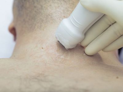 Αθηροσκλήρωση καρωτίδων: Οι επιπτώσεις στην ακοή