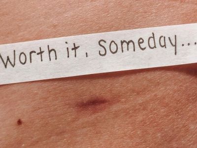 Αυτή η μικροσκοπική ουλή είναι η καθημερινή υπενθύμιση για όσα παλεύαμε τόσο καιρό