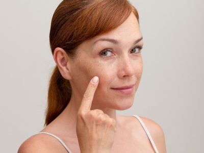 Πανάδες: Φυσικές θεραπείες που λειτουργούν