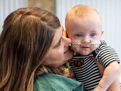 Το πρόωρο μωρό που ζύγιζε 283 γραμμάρια όταν γεννήθηκε, έγινε ενός έτους και μπήκε στο βιβλίο Γκίνες