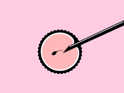 Εξωσωματική γονιμοποίηση: 10 πράγματα που πρέπει να ξέρετε πριν ξεκινήσετε