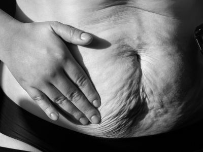 Ανασφάλειες για το σώμα: Η δυσκολία αποδοχής του μετά τη γέννα