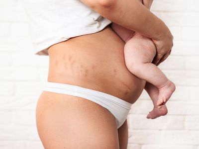 Σταματήστε να μου λέτε πως μπορεί να επανέλθει το σώμα μου μετά τη γέννα